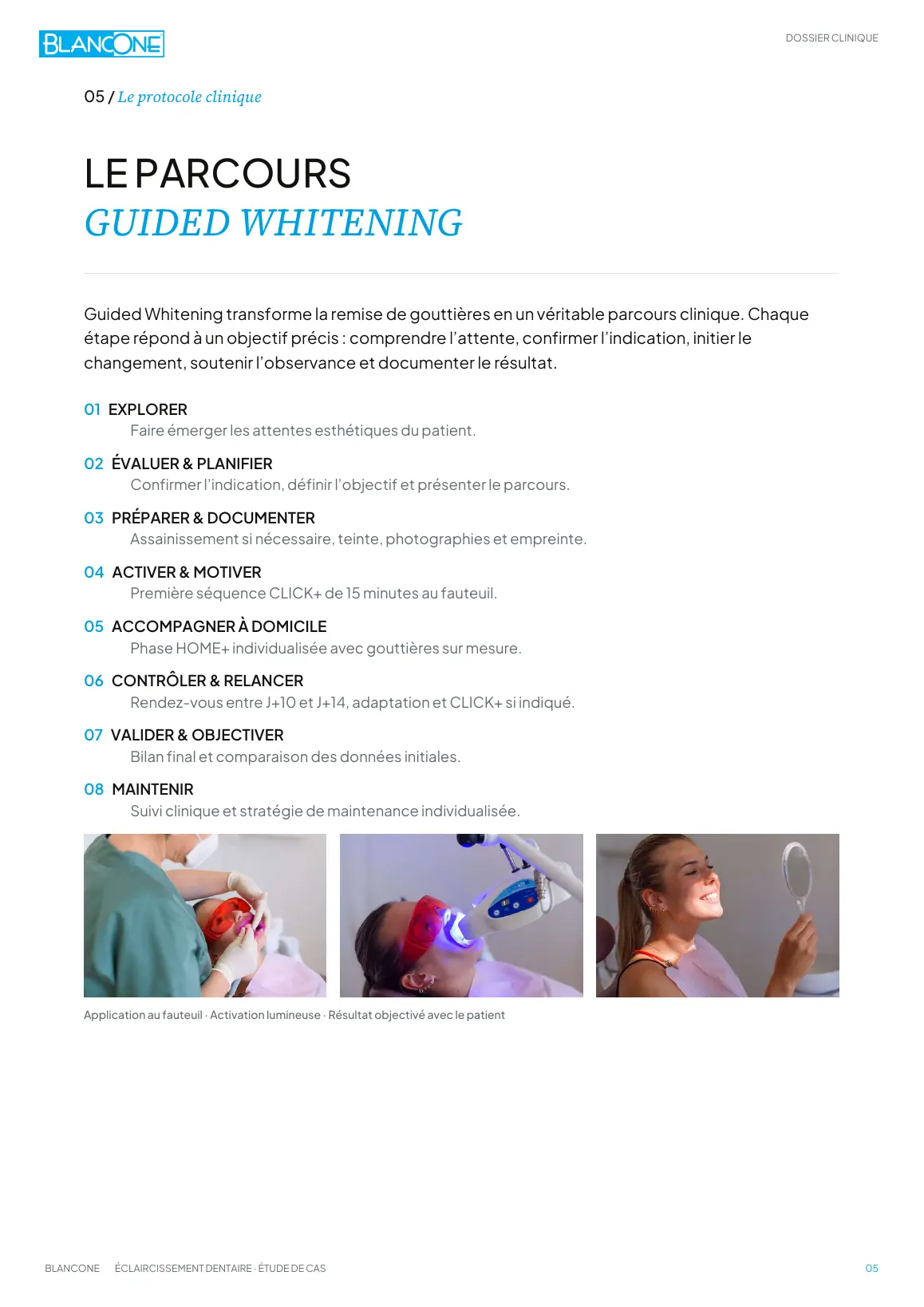 Aperçu des huit étapes du parcours Guided Whitening